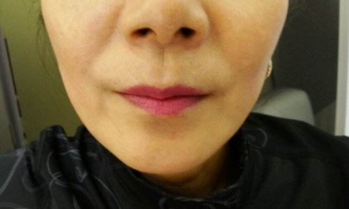 如何去除法令纹 淡化法令纹最好的方法