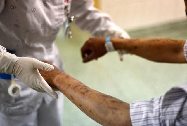 21岁女大学生宫颈癌离世,女人身体出现4个表现