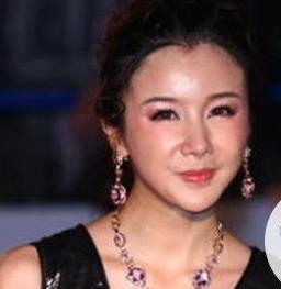 为什么女星整容脸崩后越来越像蔡明,原来蔡明