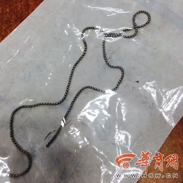 男孩尿道塞缝衣针取出时已生锈 性教育要及时