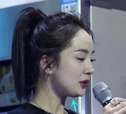 杨幂视频变脸,难道是切下颌骨后遗症?