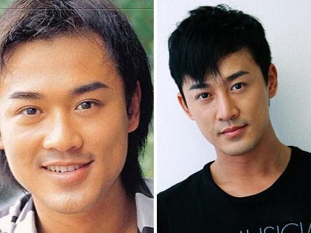 扒出了这些男星也热衷于整容