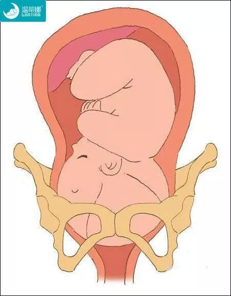 女人生孩子开骨缝真是骨头裂开?一般开多久?