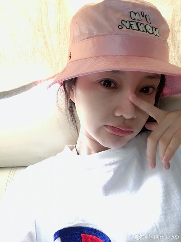 李小璐吃坏肚子拍外景 卖萌向网友求助良药 李小璐吃坏肚子拍外景 卖萌向网友求助良药