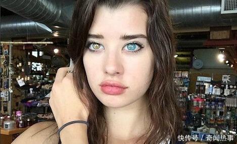 世界上十大最令人羡慕的怪病,第十种男生都想