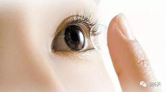 用户真实经历带你了解角膜塑形镜?原理?风险