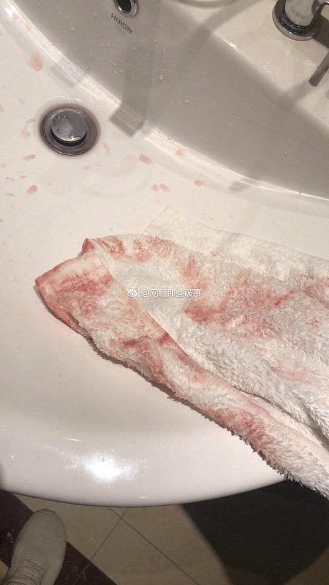 李舒克被打始末,石头花当场打电话说和仙洋不