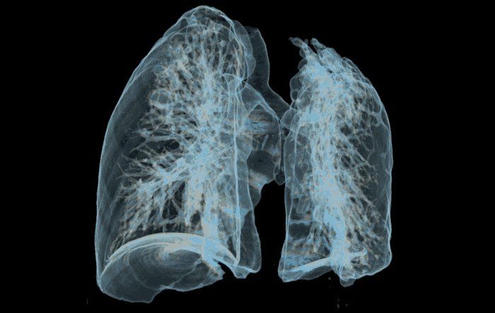 江苏幼儿园老师查出患有肺结核, 全校32人被传