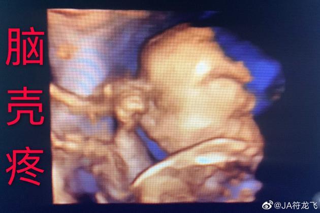 符龙飞突然官宣将当爸 妻子怀孕9月是半个圈内人(图2) 符龙飞突然官宣将当爸 妻子怀孕9月是半个圈内人(图2)