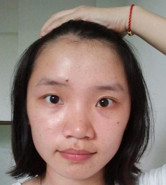 眉毛中有痣好不好?眉毛中有痣的痣相解析!