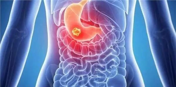 注意! 最新的防癌年龄表已公布! 癌症原来离我