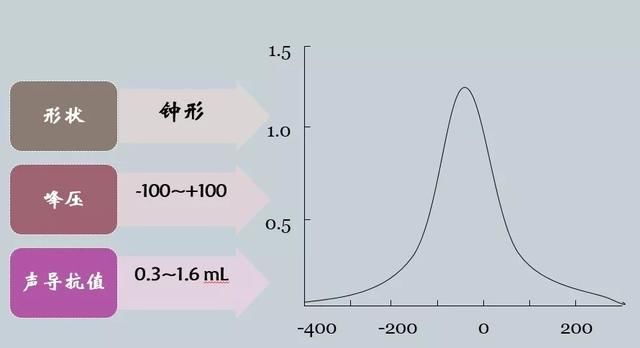 听力知识|鼓室声导抗科普篇
