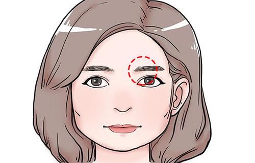 女人这几个地方长痣最好命,福多财旺,此生非富