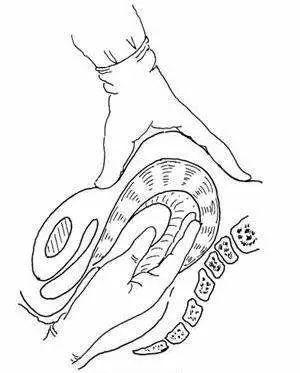 分娩】你知道什么是手剥胎盘吗?会让你疼的