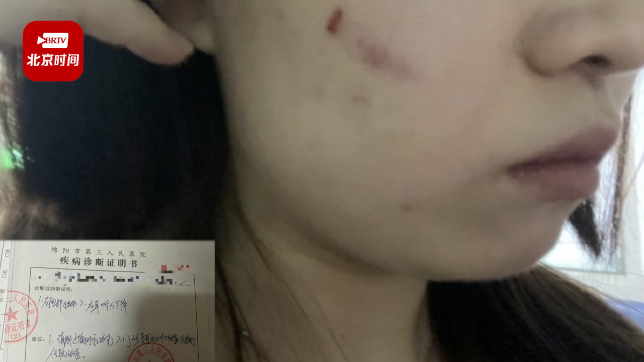 女大学生劝阻女子带男孩进更衣室遭殴打：她打伤我 还管我要精神赔偿