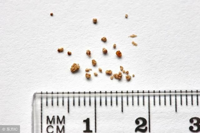 适当补充维生素C防肾结石 预防肾结石如何饮食