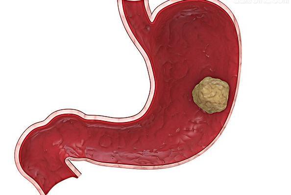 胃炎能吃什么?不能吃什么?