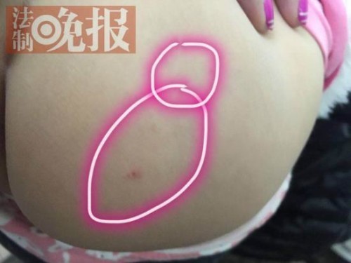 红黄蓝幼儿园4名涉嫌针刺孩子教师被批捕 红黄蓝幼儿园4名涉嫌针刺孩子教师被批捕