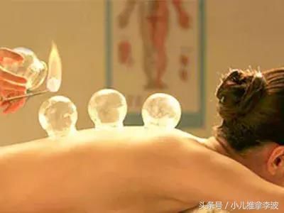 山东小儿推拿李波老师:拔罐的好处和坏处?拔罐
