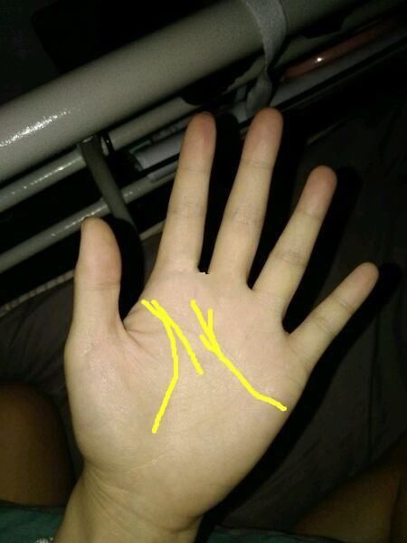 手相:男女手中这条线有横纹切过,身体病痛多,整体运势差!