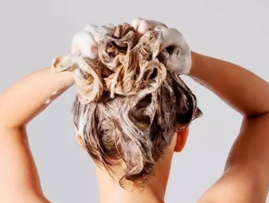 头部脂溢性皮炎怎样治疗?这些方法你一定想不