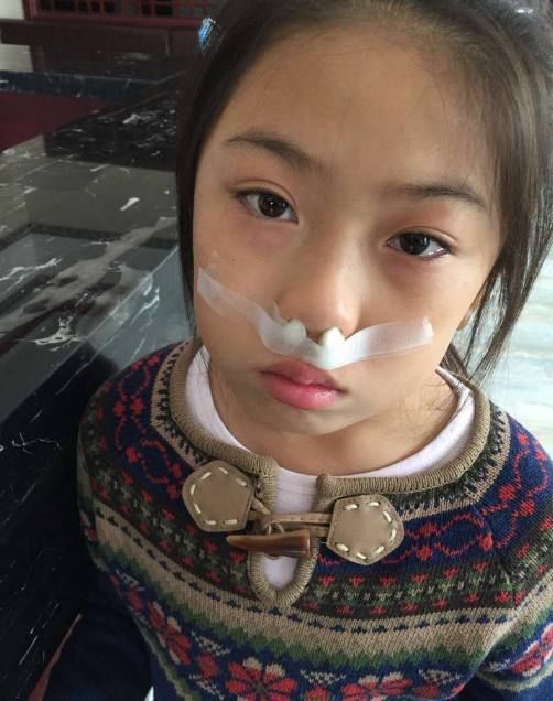 教你1个土方法彻底解决,鼻炎不再反复!