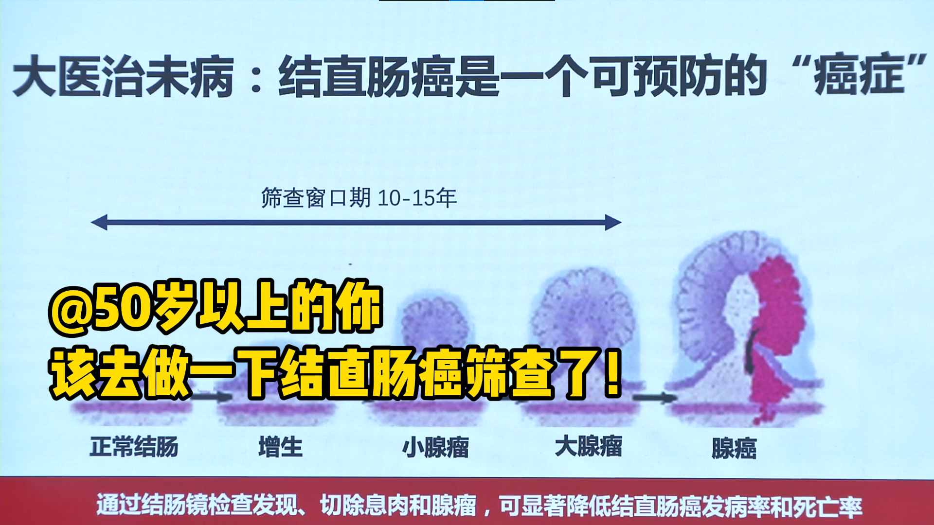 @50岁以上的你，该去做一下结直肠癌筛查了！