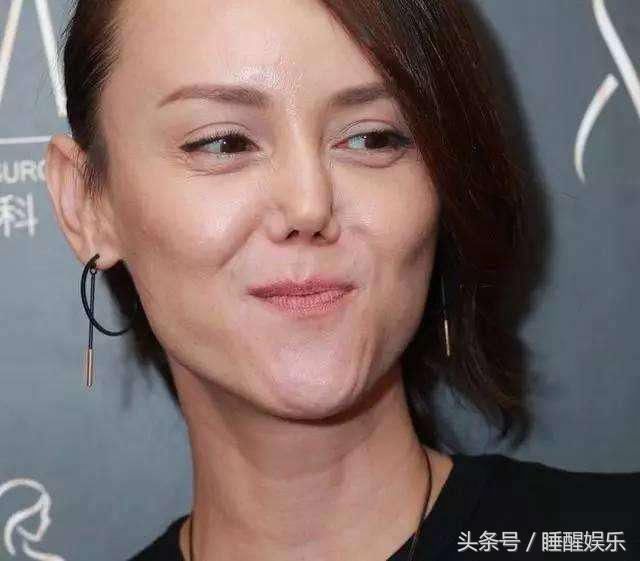 亚姐冠军韩君婷女星车晓证明,鼻子没整好就是