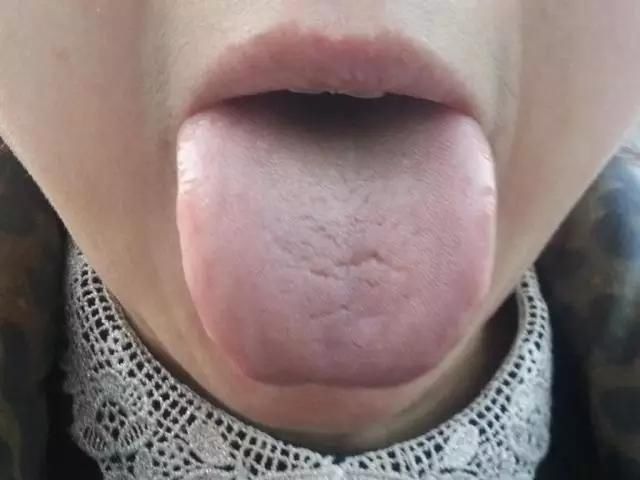 阴虚,阳虚和气虚,肾虚之人该如何过冬?关爱各