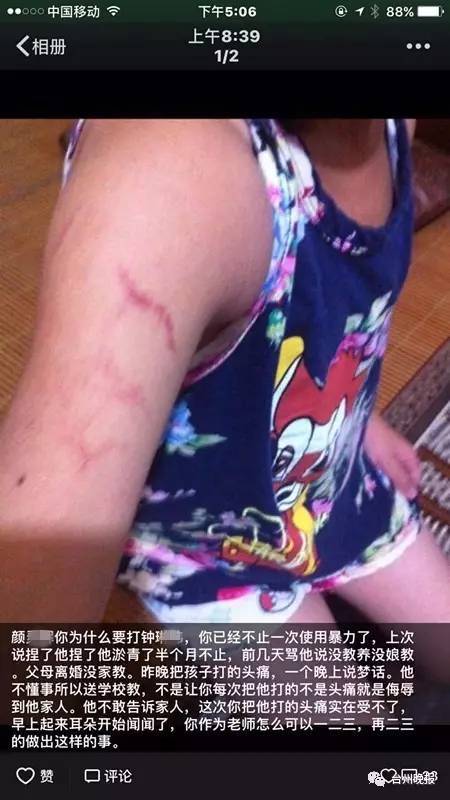 多大错?温岭一小学生被老师连打3次 耳膜都打碎了 多大错?温岭一小学生被老师连打3次 耳膜都打碎了
