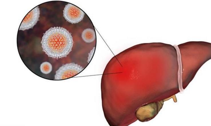 出现4个症状,肝病正在加重,请尽快去医院做肝功能检查