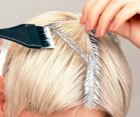 头发脂溢性皮炎怎么治 小细节要注意