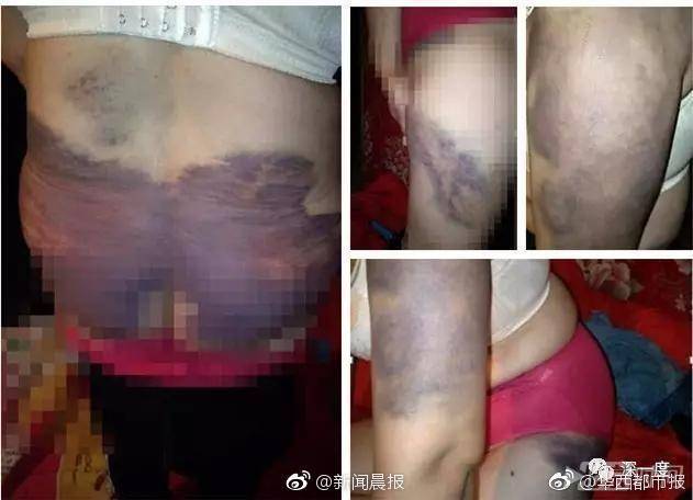 遭20年家暴女子之子不愿父母离婚：称对自己找对象不好