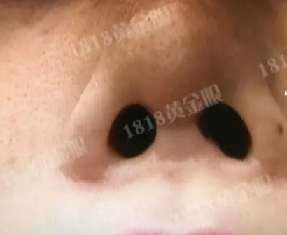 女子做整容全身麻醉 事后方知自己怀孕被迫打胎 女子做整容全身麻醉 事后方知自己怀孕被迫打胎