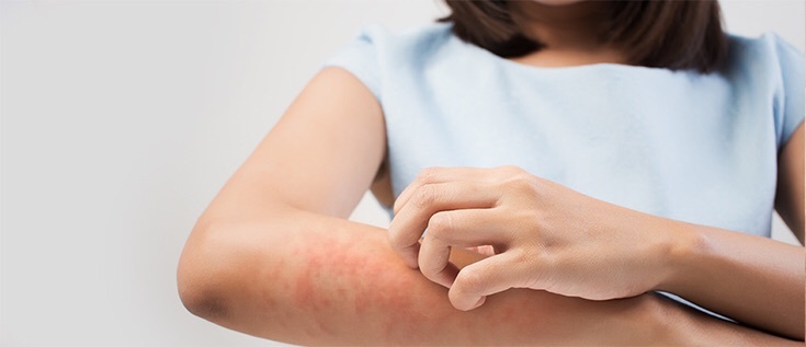 医生知道:记者湿疹被扎火针 堪比嬷嬷扎紫薇 医生知道:记者湿疹被扎火针 堪比嬷嬷扎紫薇