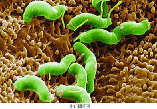 幽门螺旋杆菌最怕这种食物,每天常吃养胃又杀