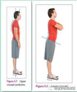 案例分析|针对骨盆前倾、上交叉综合征体态运动员的体能训练、纠正训练思路分析 案例分析|针对骨盆前倾、上交叉综合征体态运动员的体能训练、纠正训练思路分析