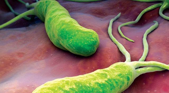 动物双歧杆菌是幽门螺杆菌的死敌,可直接扼杀