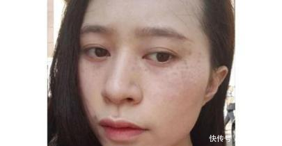 牙膏加一小小开塞露,擦脸三次斑点如雨下,胜过