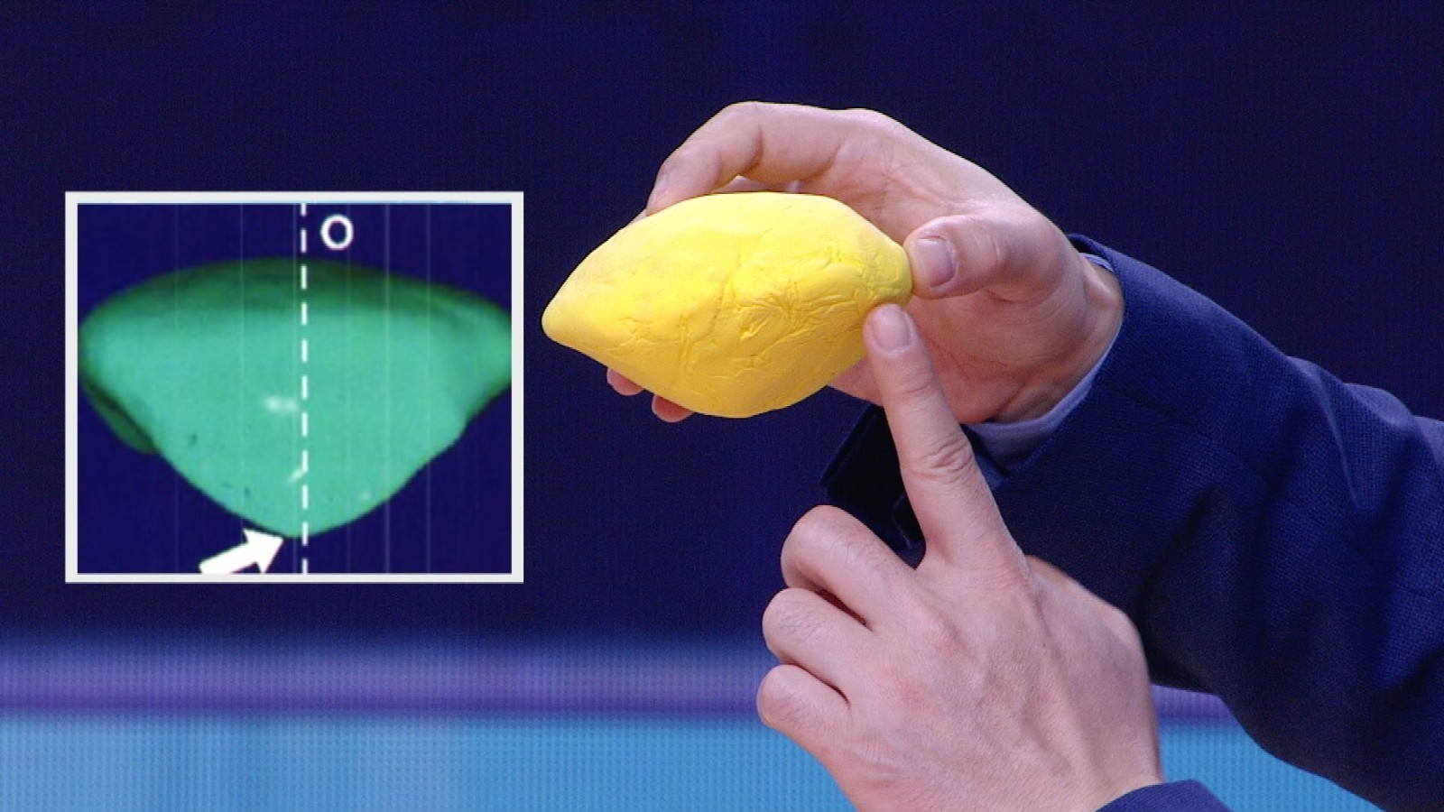 17:25《养生堂》播出《寻找最"长寿"的"波棱盖"》