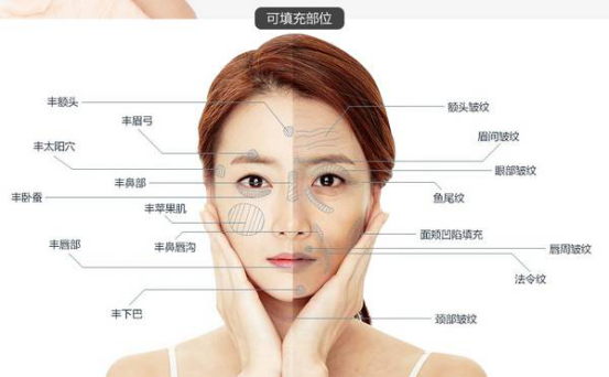 所以,要充分利用好自身的脂肪,自体脂肪填充面部是目前比较普遍流行的
