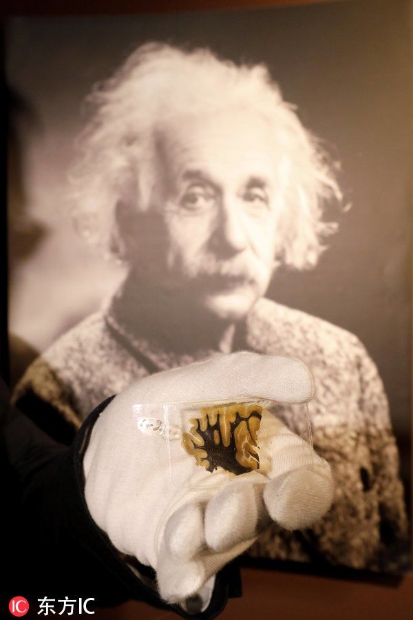 爱因斯坦大脑部分切片在德国展出