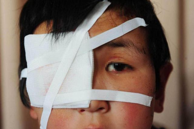 6岁宝宝突然黑眼珠不见了,就因为常玩这个,医生怒斥无知