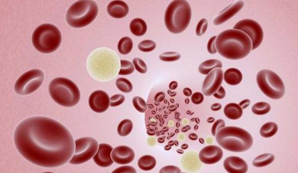 缺铁性贫血引起头晕,精神不佳,4个自我调养方