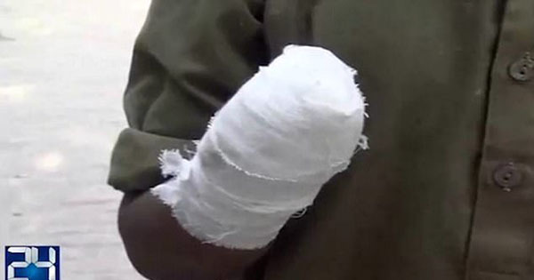 巴基斯坦13岁童工抱怨欠薪竟被雇主砍下一只手 巴基斯坦13岁童工抱怨欠薪竟被雇主砍下一只手