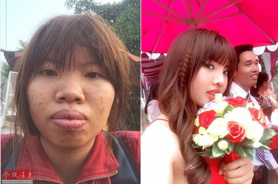 95后女孩秒嫁富二代 不敢给老公看整容前照片