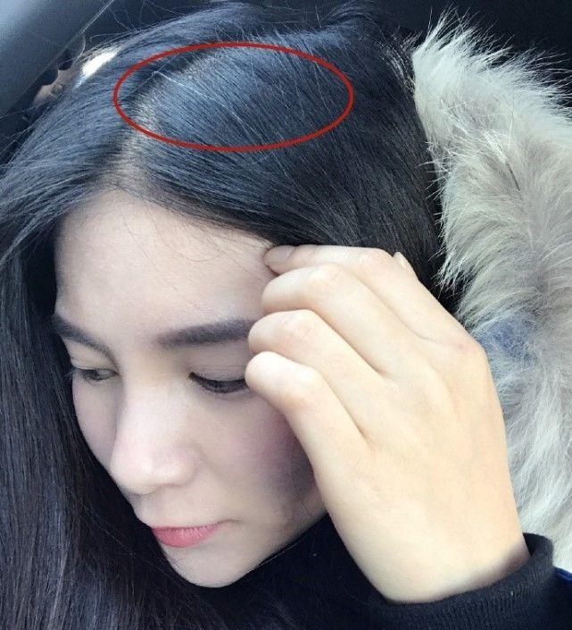 何姿发愁到有白头发 网友:结婚生个孩子是当务之急