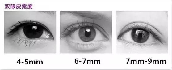 你知道双眼皮要割多宽才好看?一起看看这些就