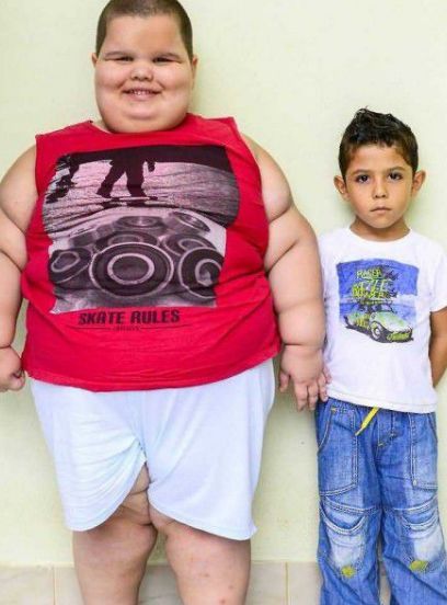 巴西5岁小男孩体重是正常儿童的3倍,重150斤,靠吸氧器入睡