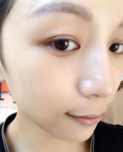 红糖加土豆,祛斑克星,每晚敷脸,7天美白祛斑